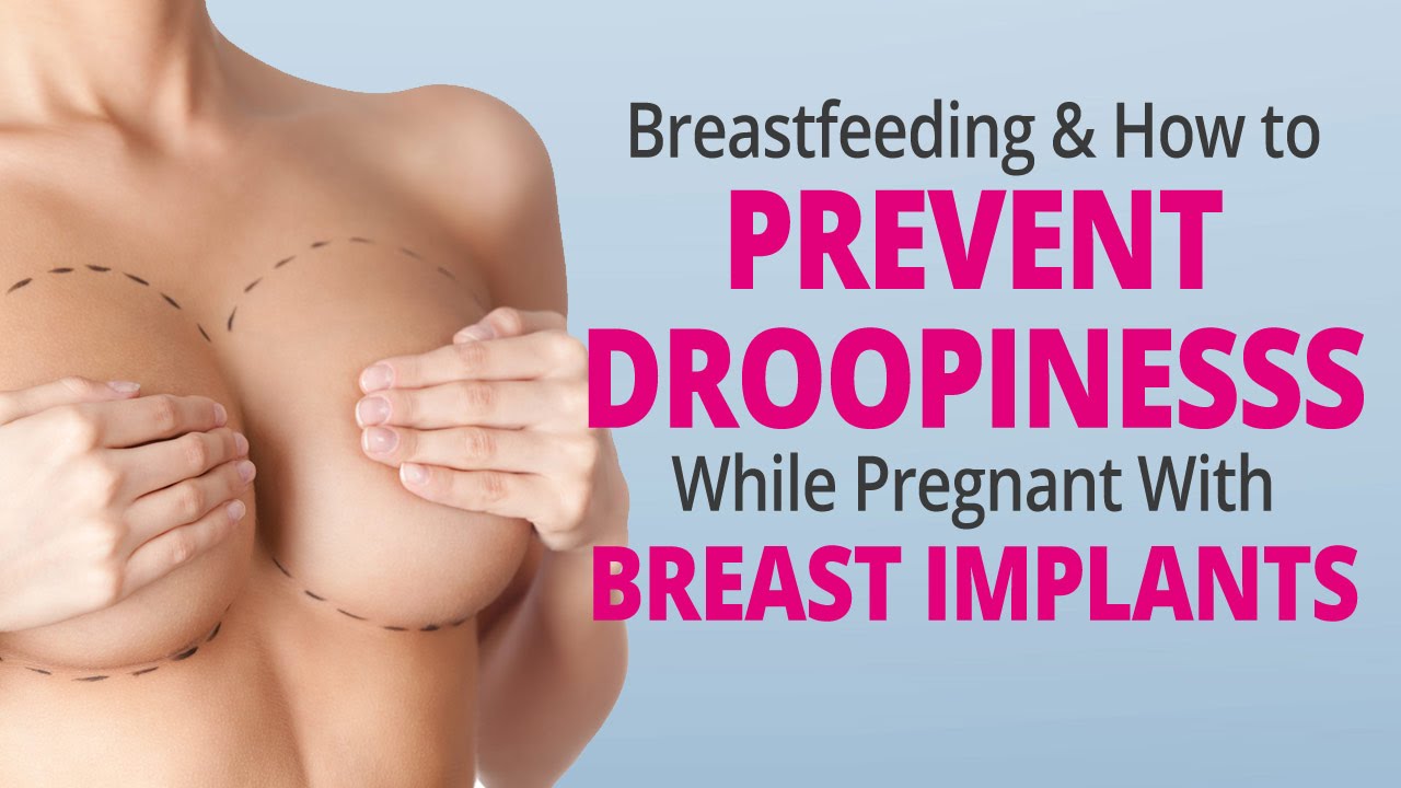 Breasts after breastfeeding