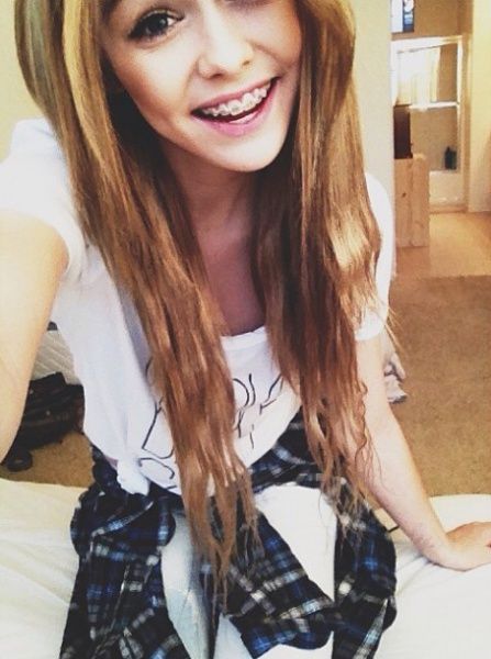 Cute girl young teens with braces facial